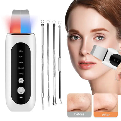 Depurador ultrasónico de piel facial