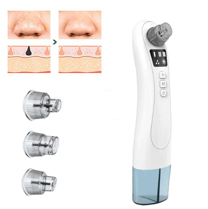 Clear Skin Electric Blackhead Remover